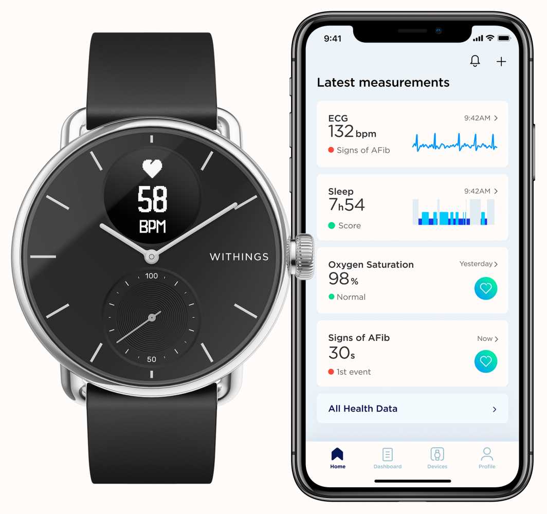 Withings ScanWatch Hybrid Smartwatch with ECG, heart rate and oximeter 38mm  Black HWA09-MODEL 2-ALL-INT - Best Buy
