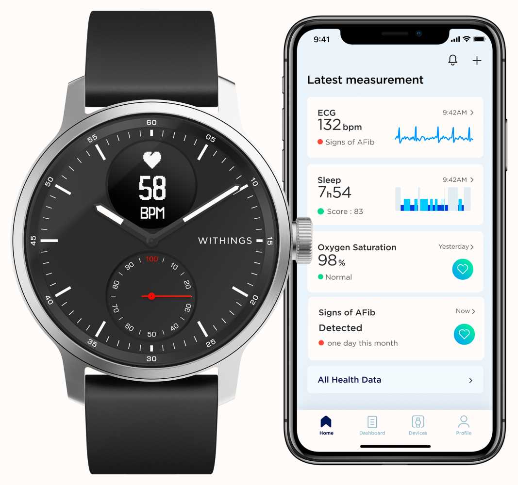 Withings ScanWatch - Hybrid Smartwatch With ECG (42mm) Black